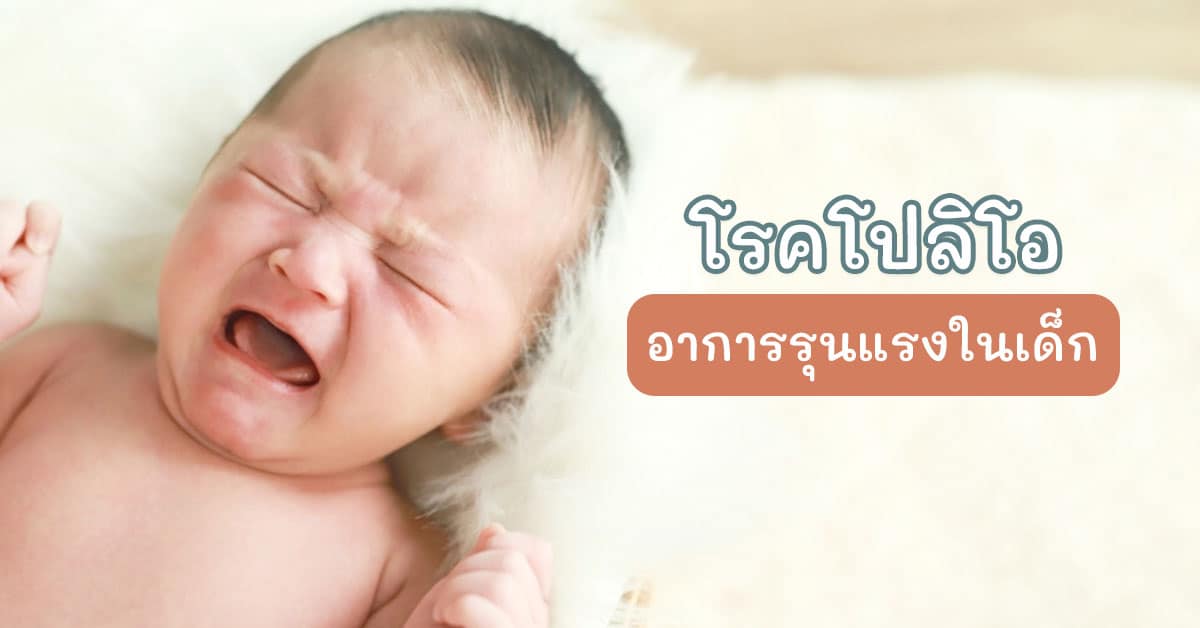 โปลิโอ 2