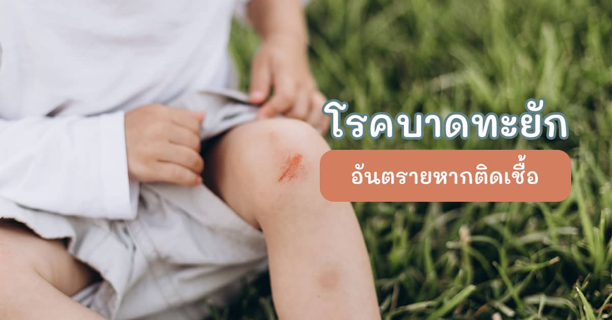 โรคบาดทะยัก