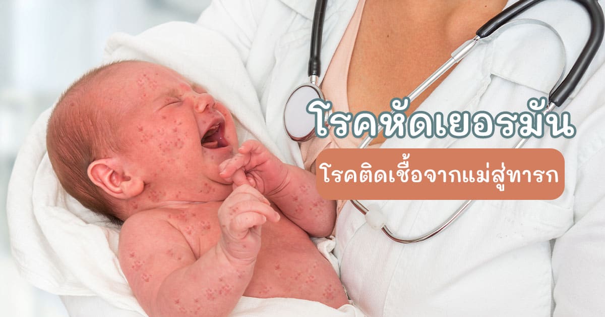 โรคหัดเยอรมัน