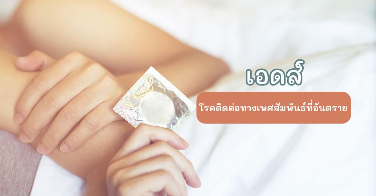 เอดส์