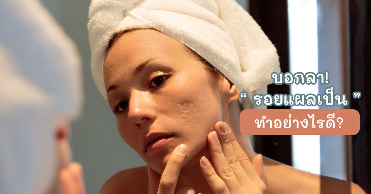how to treat scars