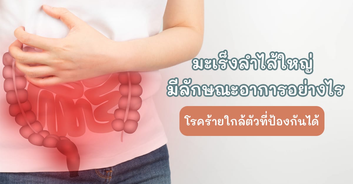 มะเร็งลำไส้ใหญ่